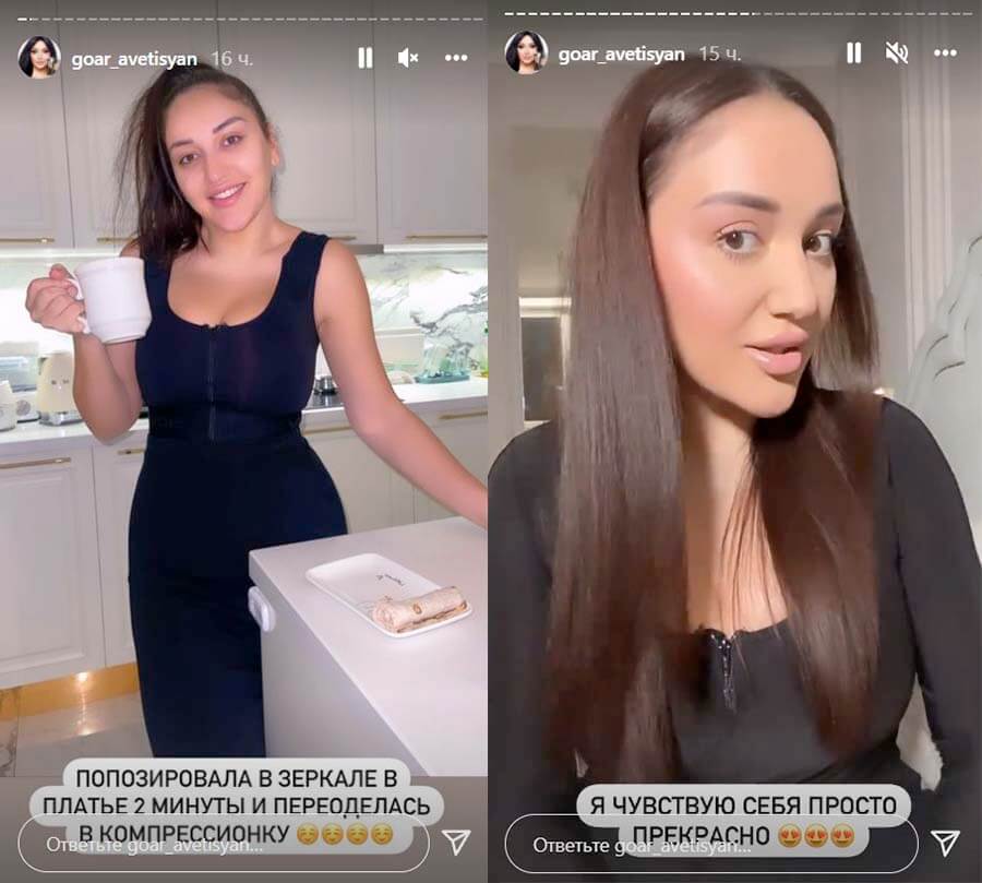 Гоар Аветисян как себя чувствует после пластики