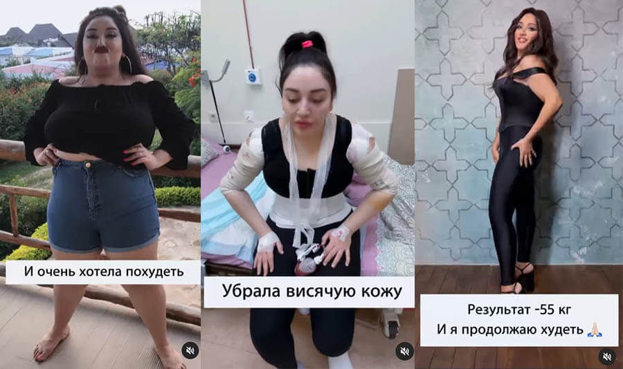 Гоар Аветисян после похудения