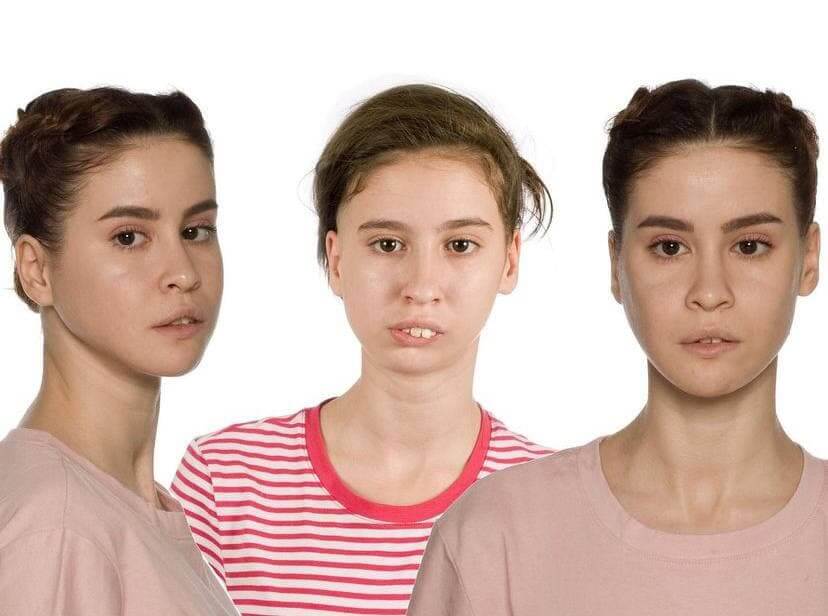 Хахадетка операции