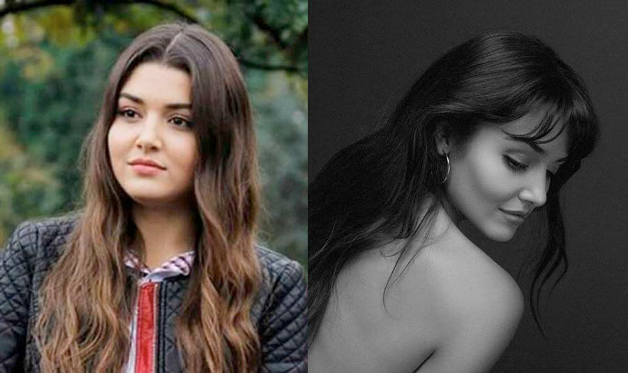 Ханде Эрчел до&nbsp;и&nbsp;после пластики