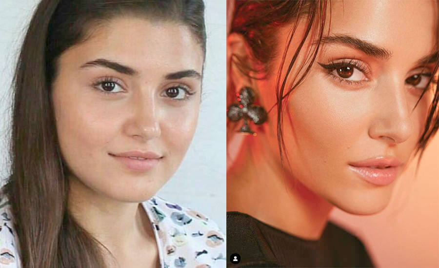 Ханде Эрчел пластика