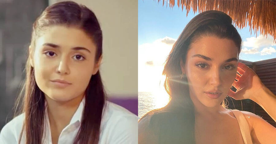 Ханде Эрчел до&nbsp;и&nbsp;после