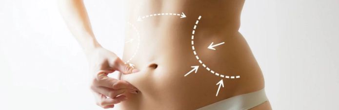 Как правильно корректировать фигуру с помощью пластики