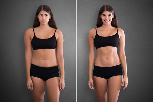 Абдоминопластика для красивой фигуры