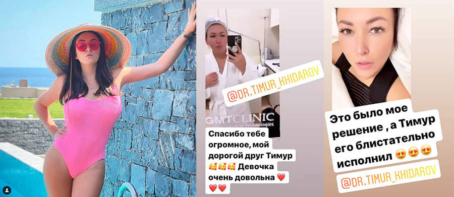 Ирина Дубцова достала импланты из&nbsp;груди