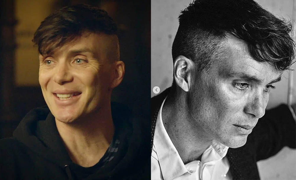 Киллиан Мерфи ботокс