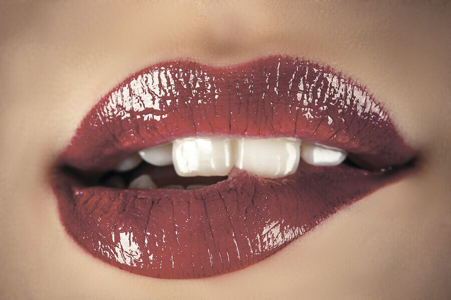 Грамотный липофилинг губ с&nbsp;коррекцией формы фото до&nbsp;после
