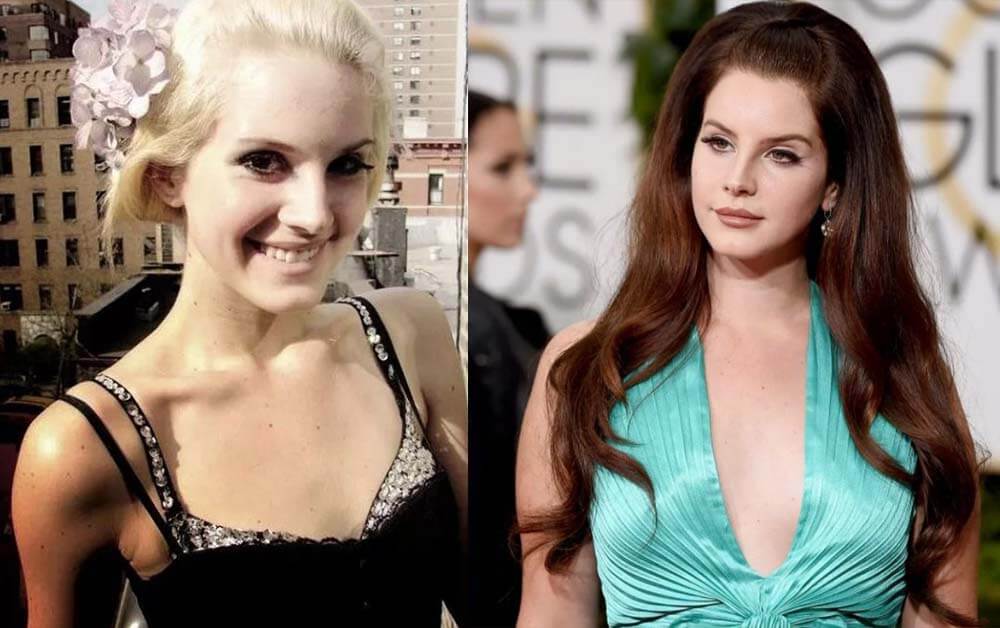 Лана Дель Рей до&nbsp;и&nbsp;после