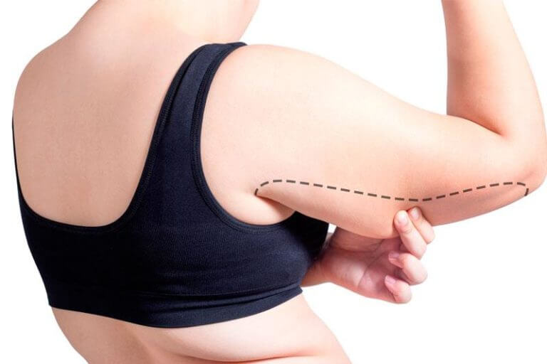 Фото до пластики рук, что корректировать