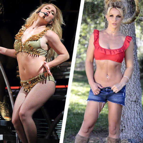 Звездная липосакция фото до&nbsp;после