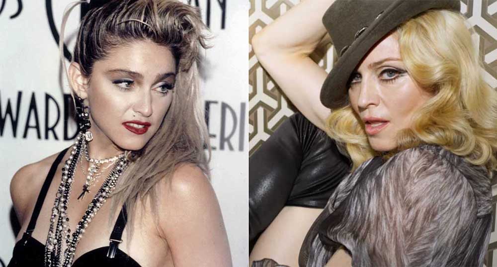 Мадонна ринопластика