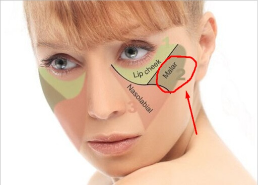 Что такое малярные мешки и как с ними бороться