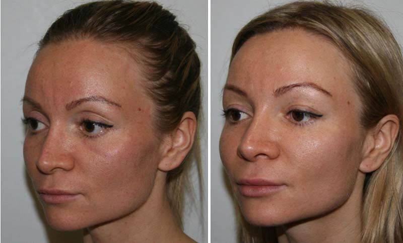 Малярные мешки – все что следует о них знать