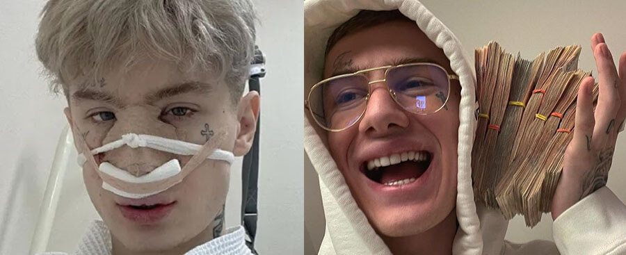 Олег Манекен после пластики