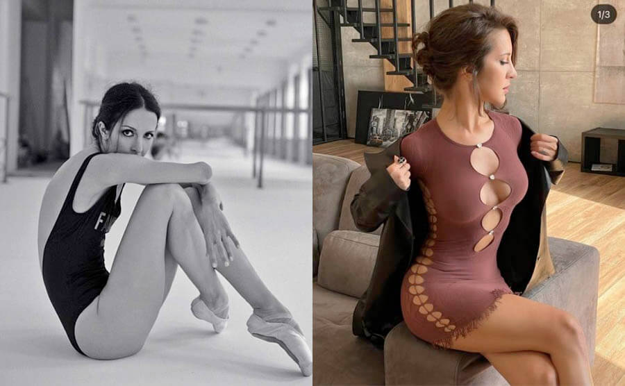 Матильда Шнурова до и после пластики