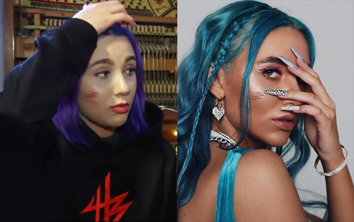 Миа Бойка что с лицом