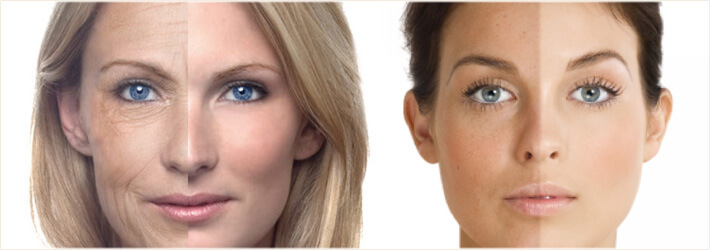 Результат фотоомоложения на&nbsp;молодой и&nbsp;возрастной коже