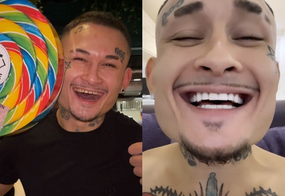 Моргенштерн зубы