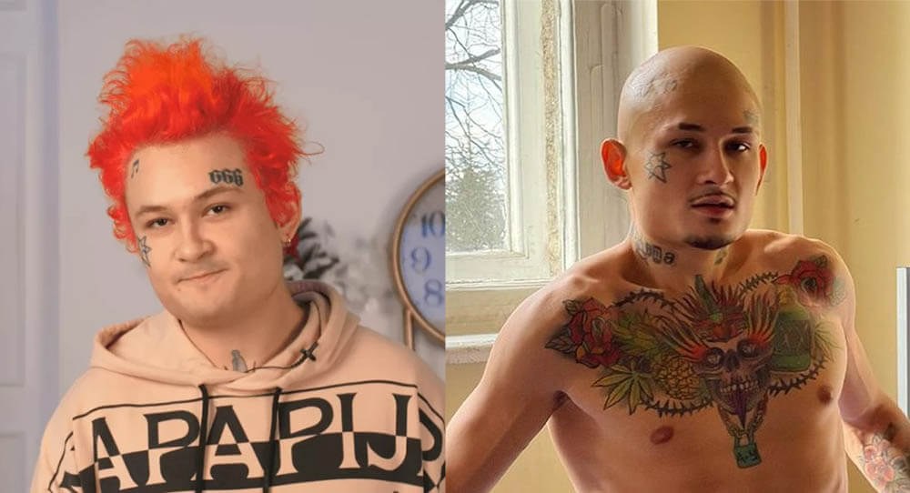 Моргенштерн пластика скул