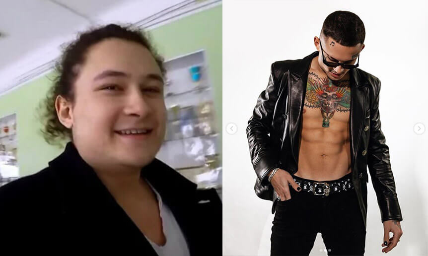 Моргенштерн до и после пластики