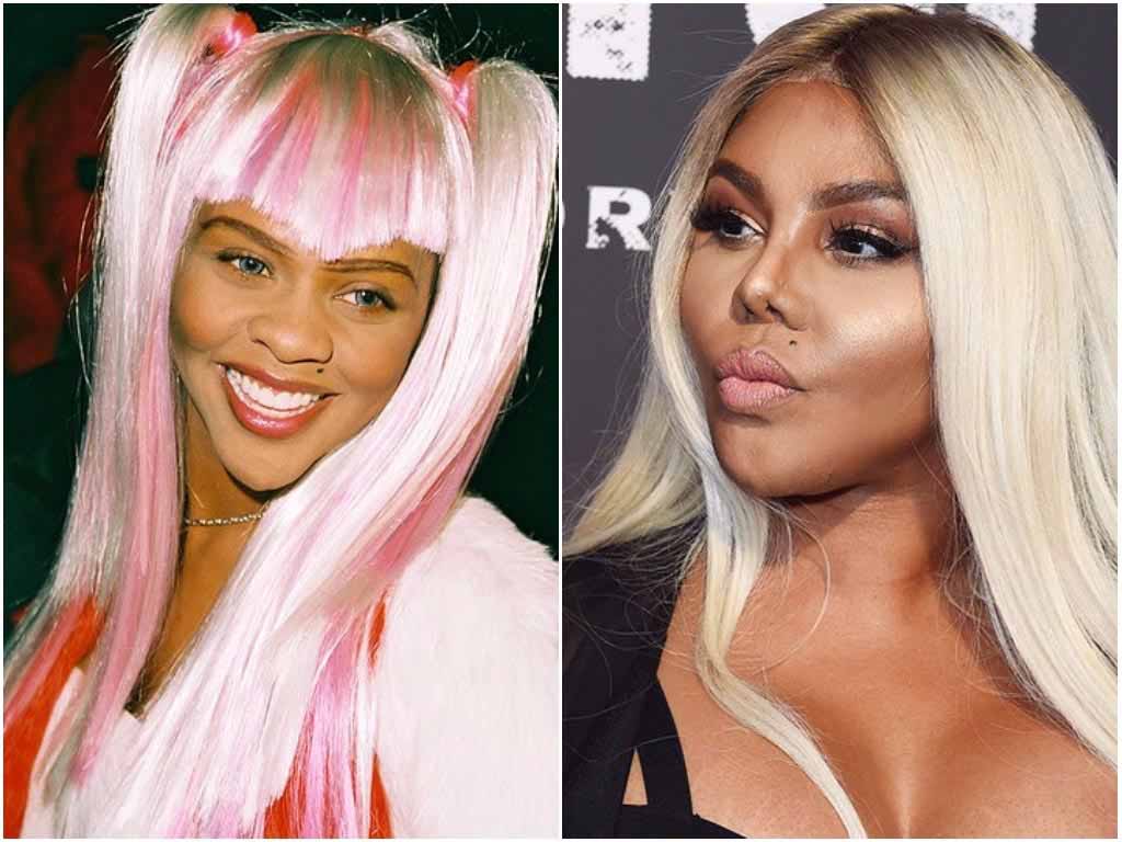 Фото до после неудачной ринопластики: со звездами такое тоже случается