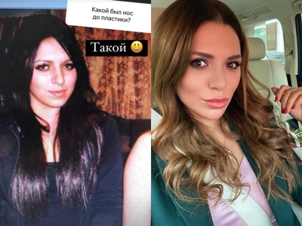 Лера Куденкова до&nbsp;и&nbsp;после