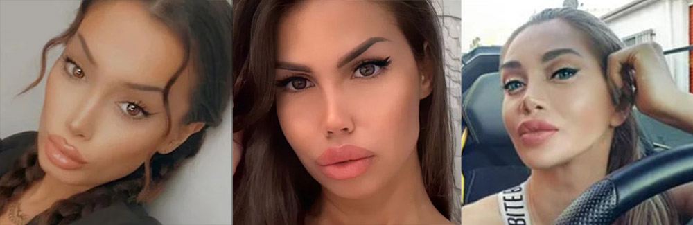 Новый тренд — кукольный нос