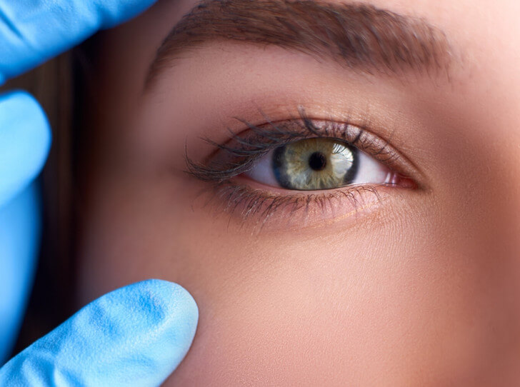 Подтяжка глаз в&nbsp;пластике лица