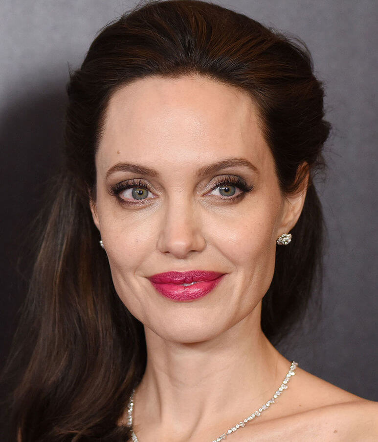 Эффект ботулинотерапии