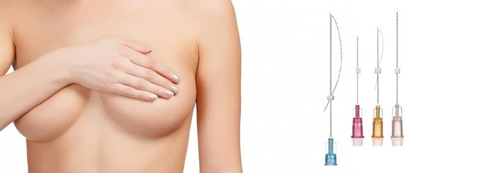 Подтяжка нитями и ее эффективность