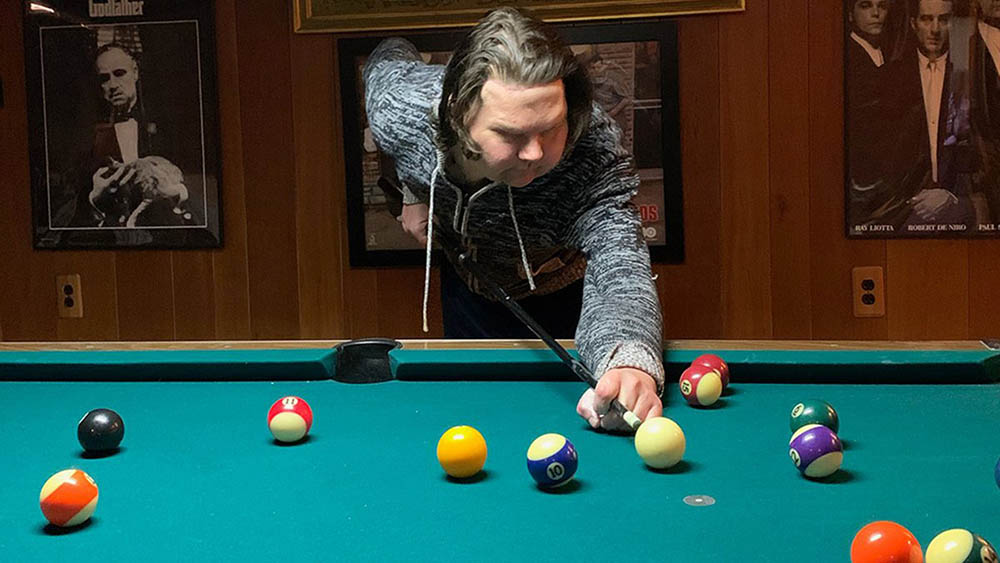 Пересадка рук и&nbsp;лица у&nbsp;Джо