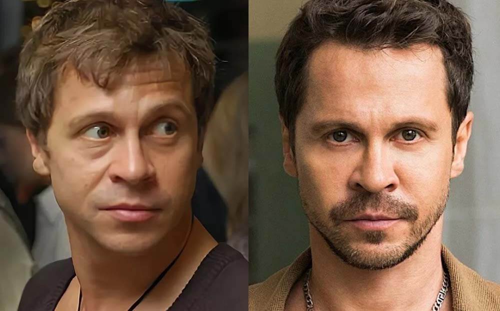 Павел Деревянко ботокс