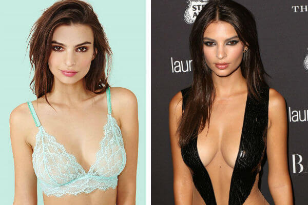 Фото до&nbsp;после увеличения груди