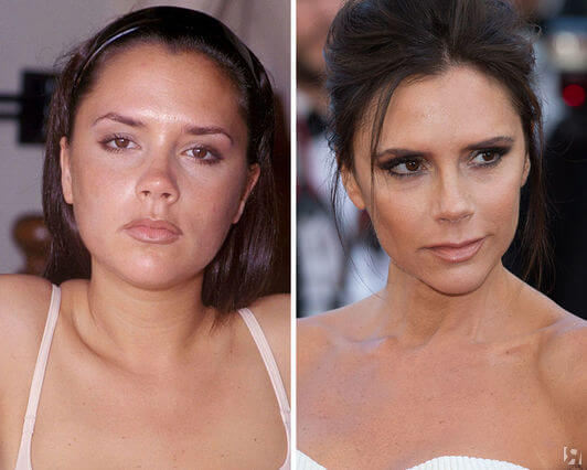 Фото до&nbsp;после удаления комков Биша