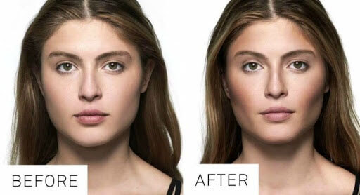 Удаление комков Биша фото до после