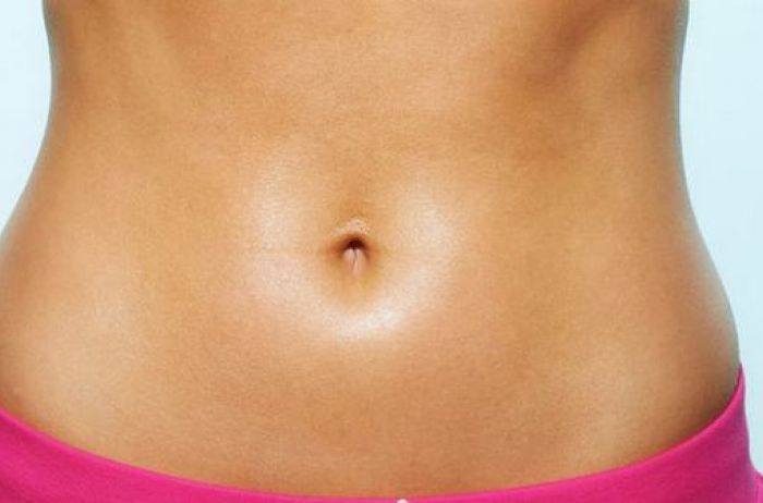 Идеальная форма и размер после коррекции пупка