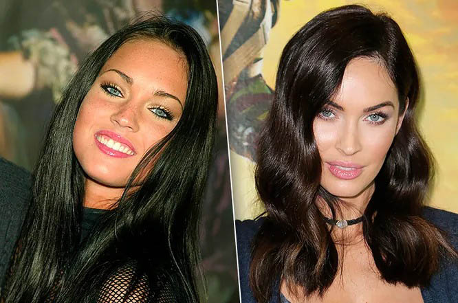 Меган Фокс: блефаропластика век фото до&nbsp;после