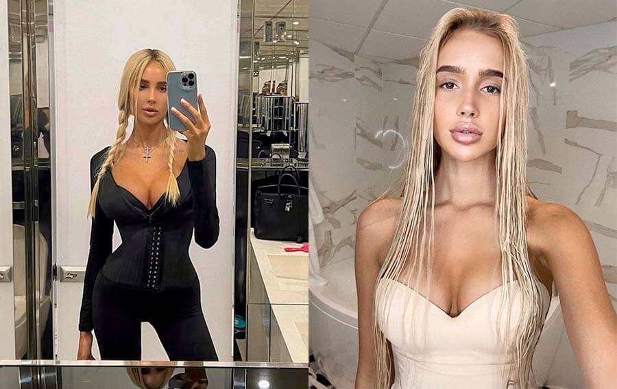 Саша Дони до&nbsp;пластики и&nbsp;после