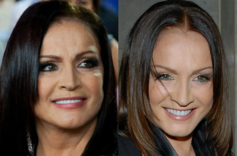 София Ротару до&nbsp;и&nbsp;после