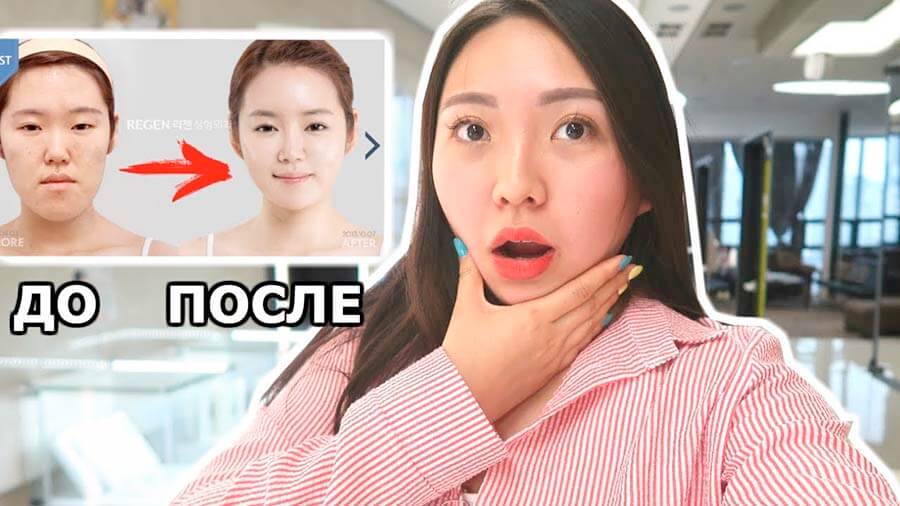 Фото до после правильной пластики