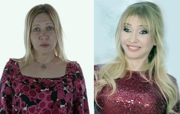 Татьяна Иванова до и после пластики