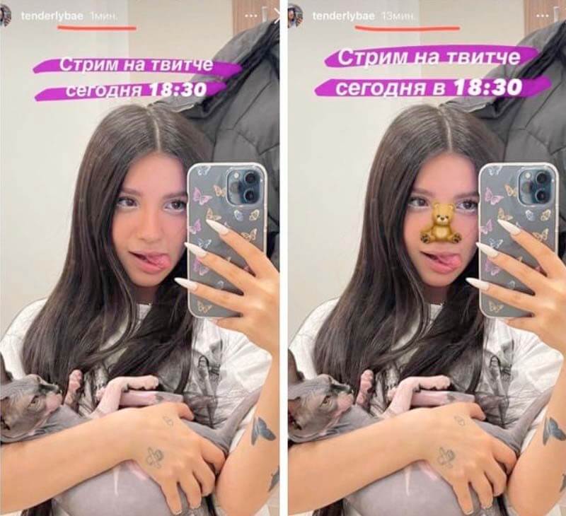 Тендерлибае после ринопластики