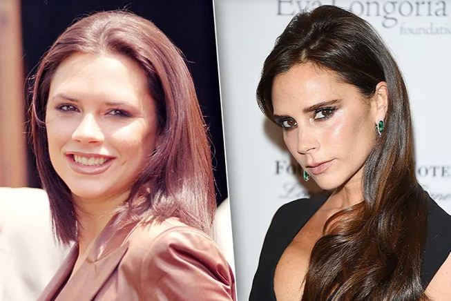 Здвездные примеры фото до&nbsp;после удаление мешков Биша