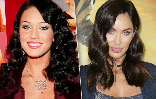 Фото до&nbsp;после удаления комков Биша