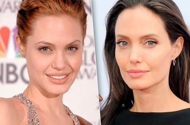 Здвездные примеры фото до&nbsp;после удаление комков Биша