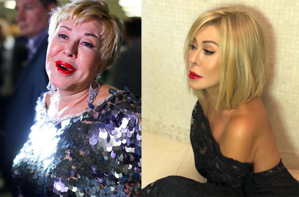 Любовь Успенская пластика лица