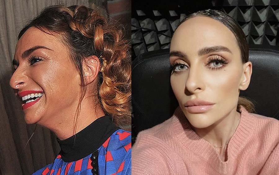 Екатерина Варнава нос