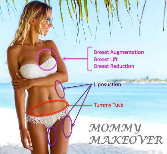 Красивое тело после рождения ребенка &ndash; не&nbsp;миф