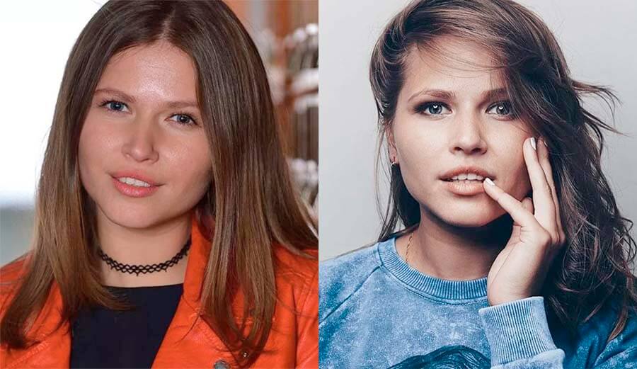 Юлия Топольницкая губы