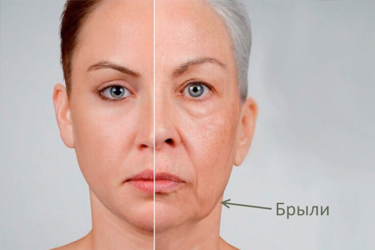 Как выглядят брыли и&nbsp;как они формируются?